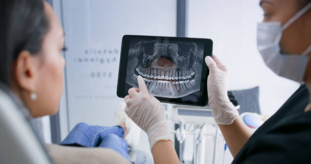 Licensed Tooth Extraction service in Kitsap County County, WA - Smile Center Dentistry